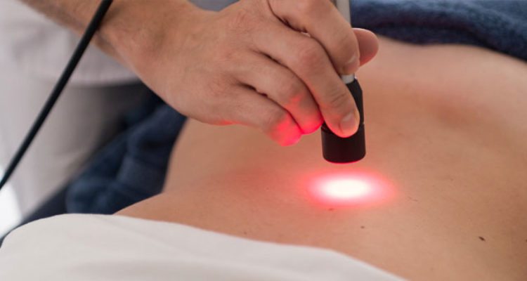 I benefici della Laserterapia